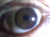 My eye 1